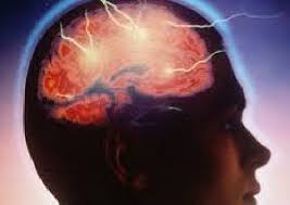 بررسی مقایسه ای شاخص (Berg  ) در بیماران سکته مغزی وافراد سالم